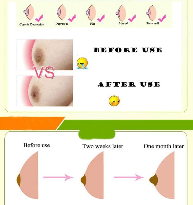 Nipple Puller BD - use